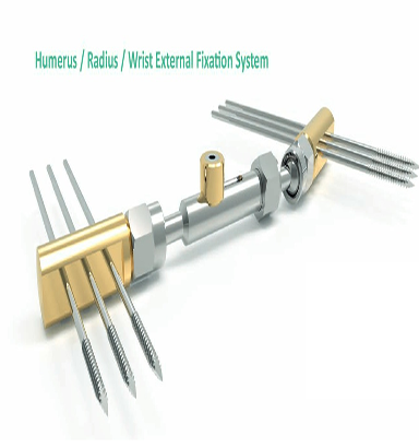 Humerus/Radius/Wrist External Fixation System